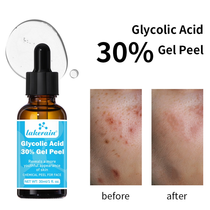 Lactic Acid Toner - 30% 글리콜산 필 젤 전문 등급