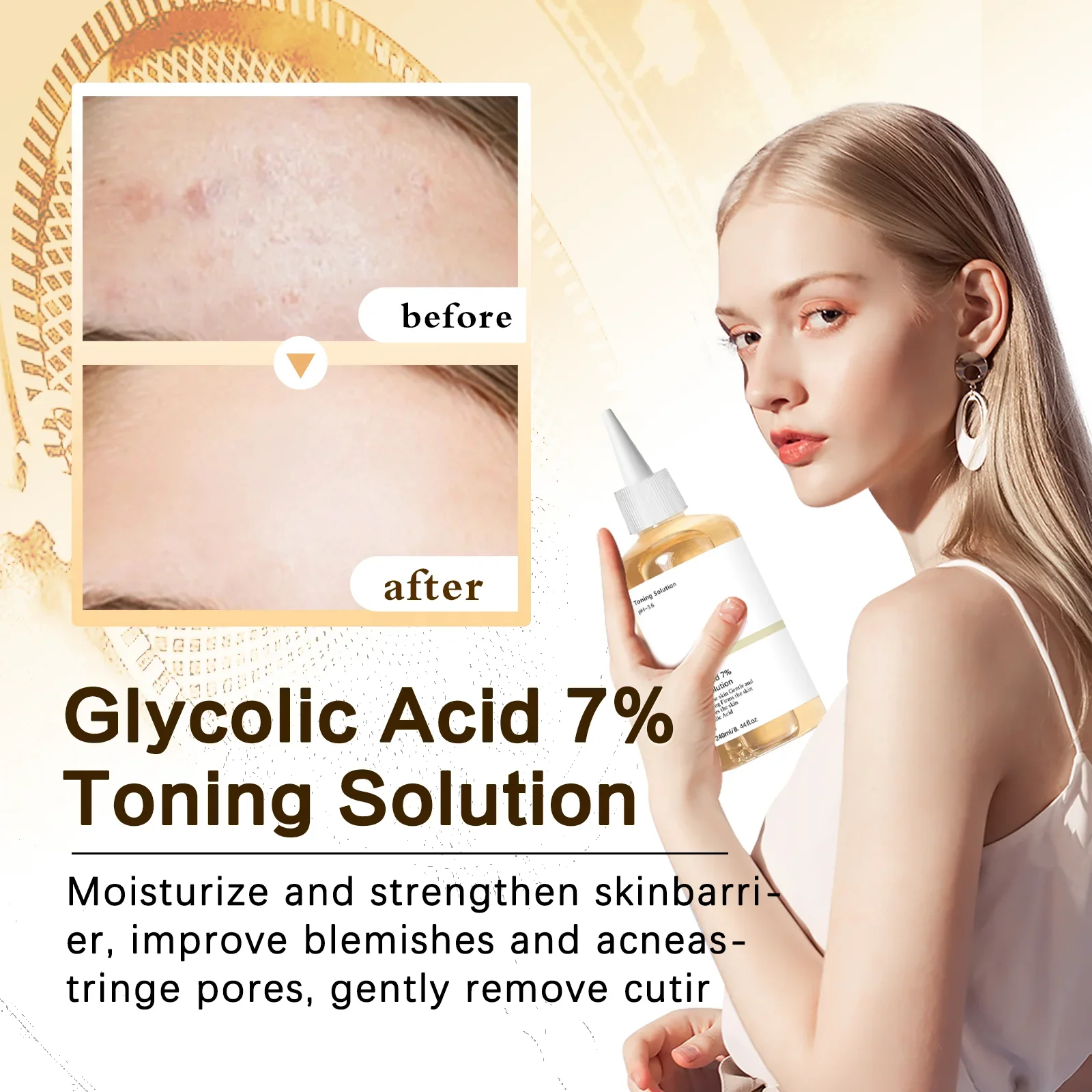 글리콜산 7% 토닝 솔루션 얼굴 각질 제거제 여드름 및 - Lactic Acid Toner 리뷰 및 가격