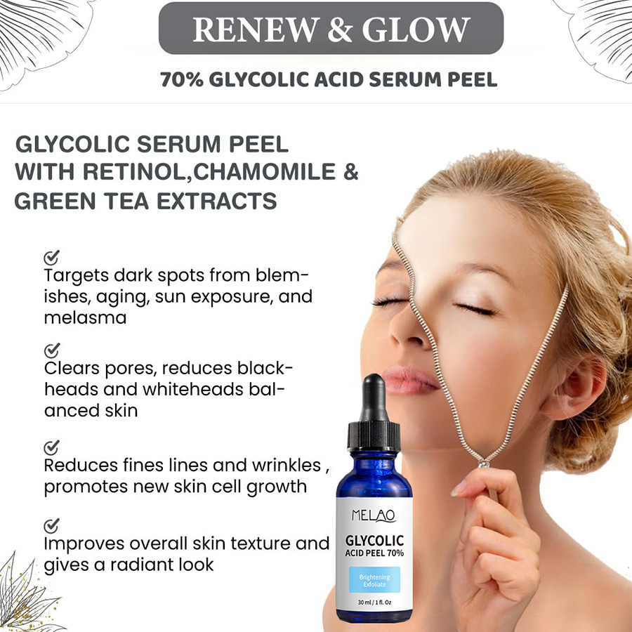 70% 글리콜산 세럼 필링 추출물, 주름, 여드름 흉터 - Lactic Acid Toner 리뷰 및 가격